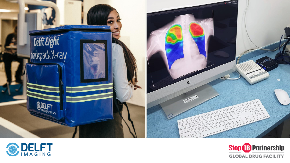 Procuring CAD4TB & Delft Light via GDF Diagnostics Catalogue Delft